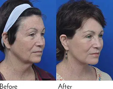 Testimonials - Garcia Facial Plastic Surgery