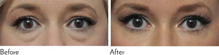 Testimonials - Garcia Facial Plastic Surgery