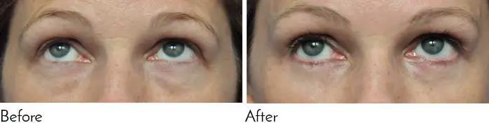 Testimonials - Garcia Facial Plastic Surgery