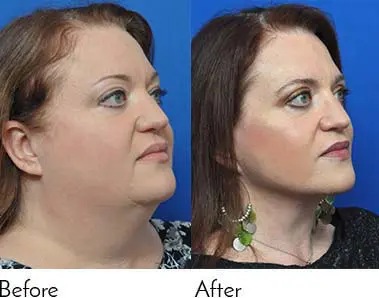 Testimonials - Garcia Facial Plastic Surgery