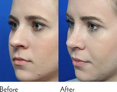 Testimonials - Garcia Facial Plastic Surgery