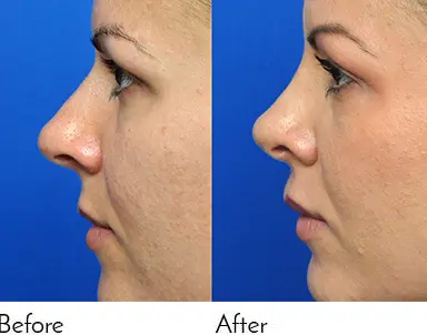 Testimonials - Garcia Facial Plastic Surgery