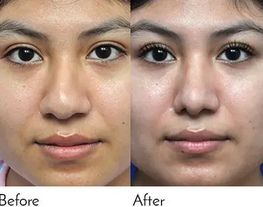 Testimonials - Garcia Facial Plastic Surgery