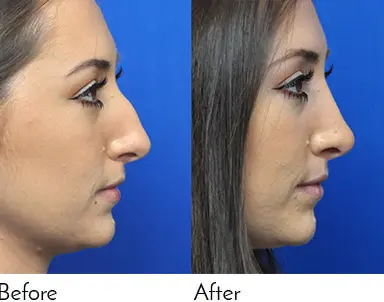 Testimonials - Garcia Facial Plastic Surgery