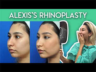 Rhinoplasty in Jacksonville, FL