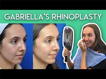 Rhinoplasty in Jacksonville, FL