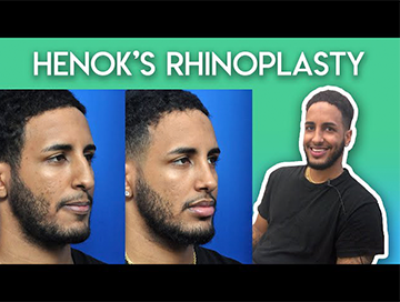 Rhinoplasty in Jacksonville, FL