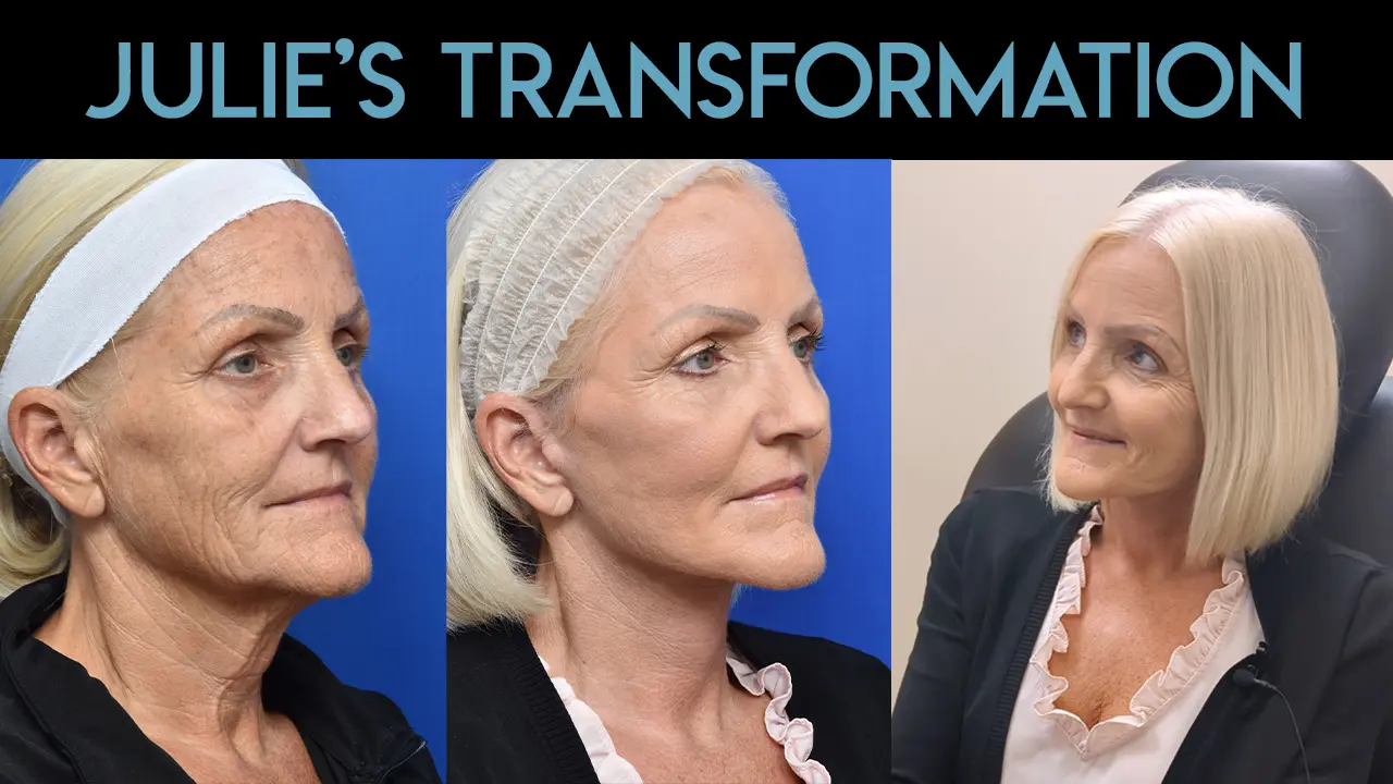 Fat Grafting in Jacksonville, FL