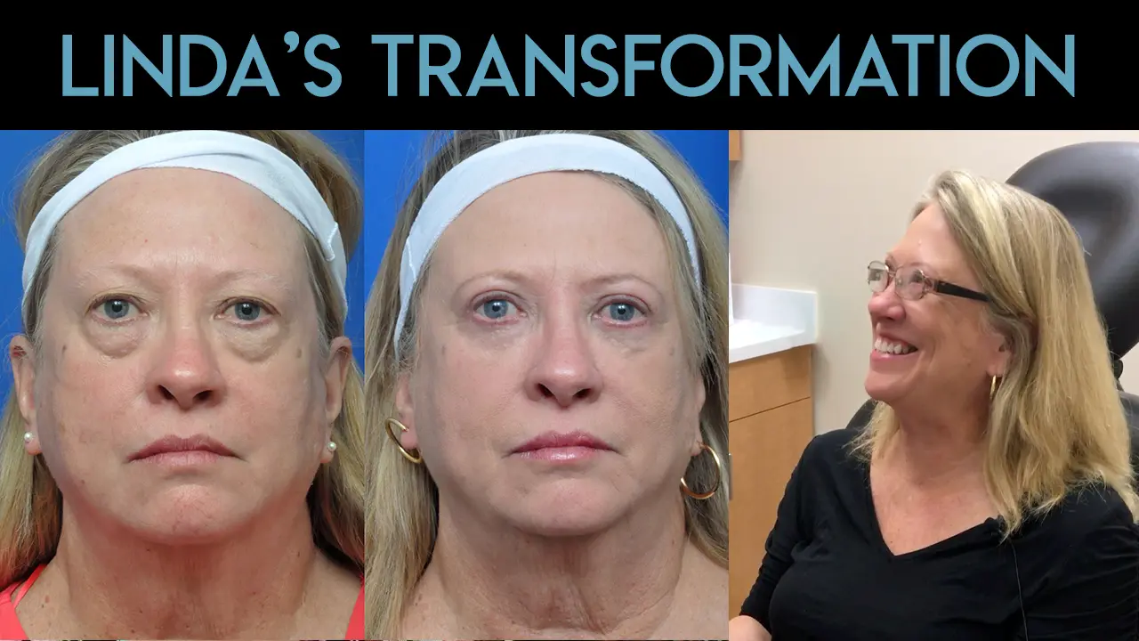 Fat Grafting in Jacksonville, FL