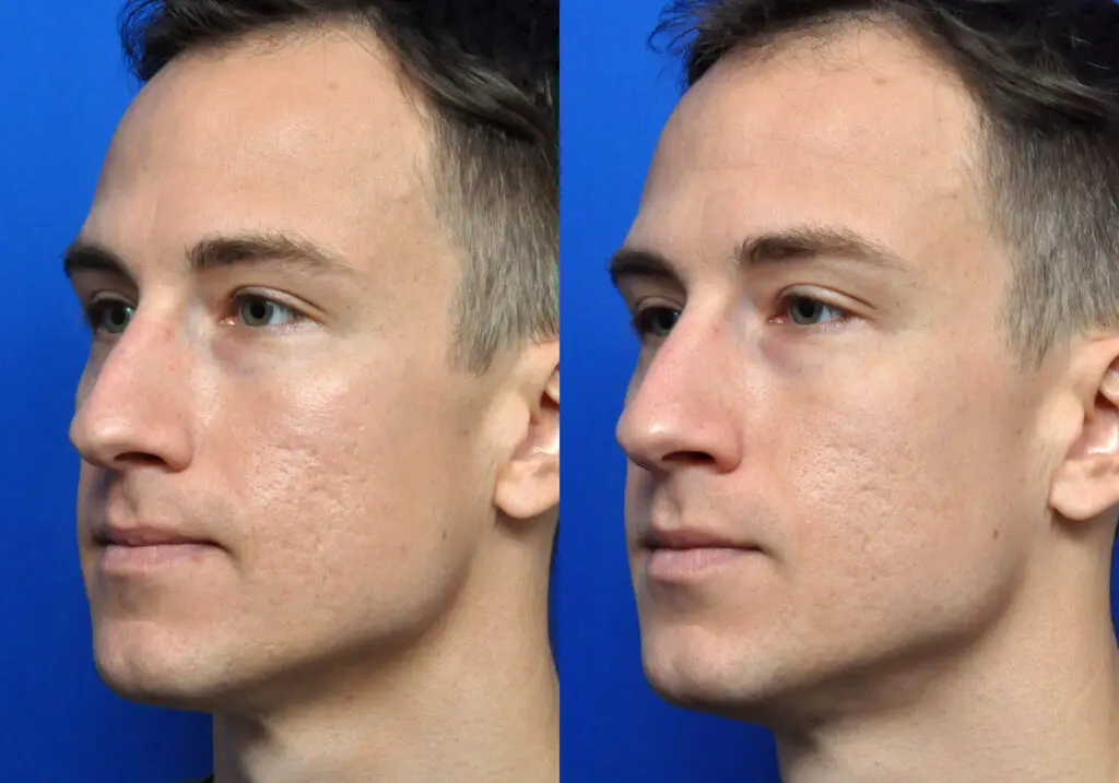 Bellafillยฎ in Jacksonville, FL