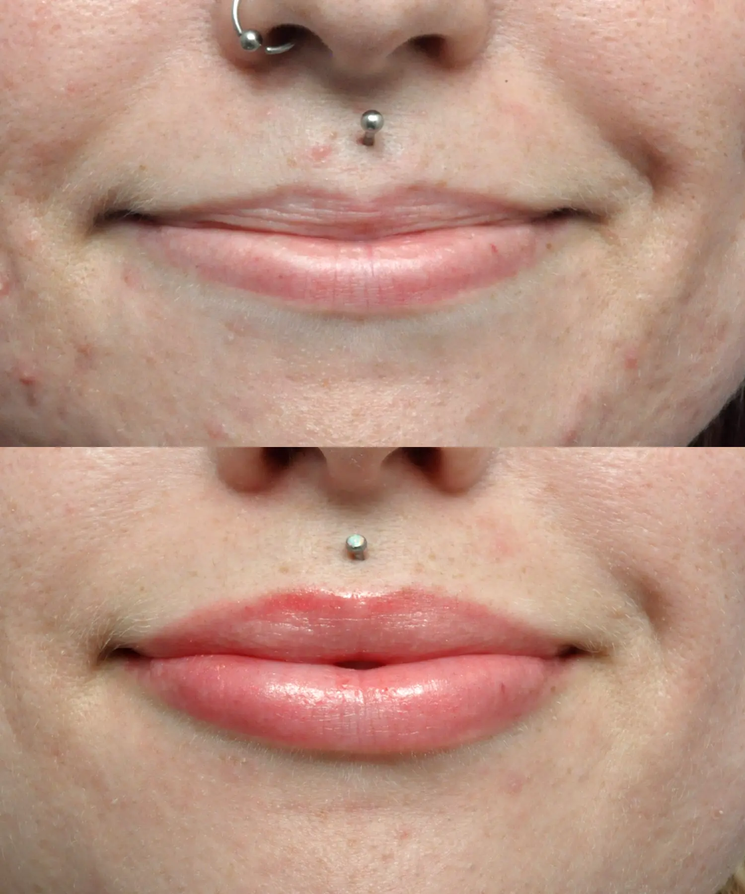 Juvedermยฎ in Jacksonville, FL