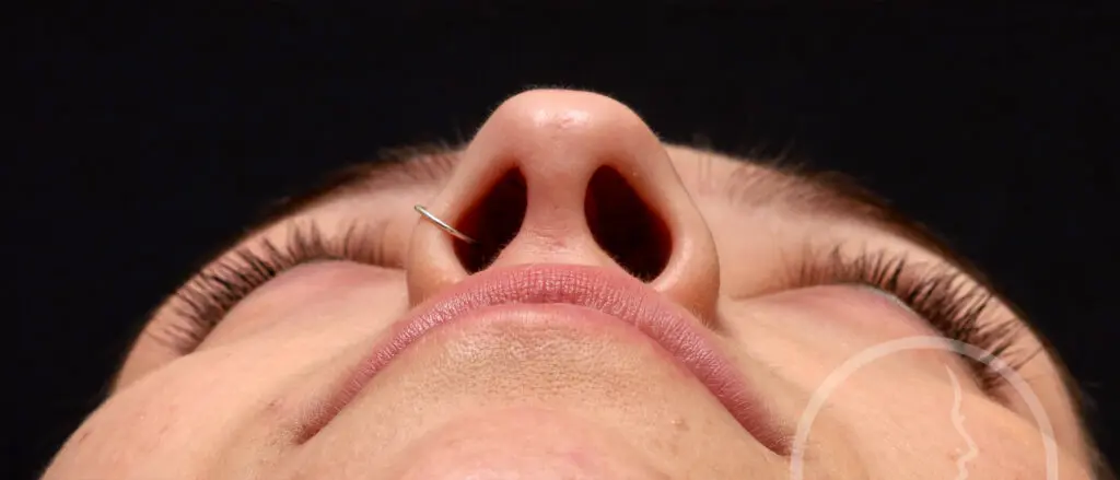 Plastic Surgery Before and After Pictures in Jacksonville, FL - Garcia Facial Plastic Surgery