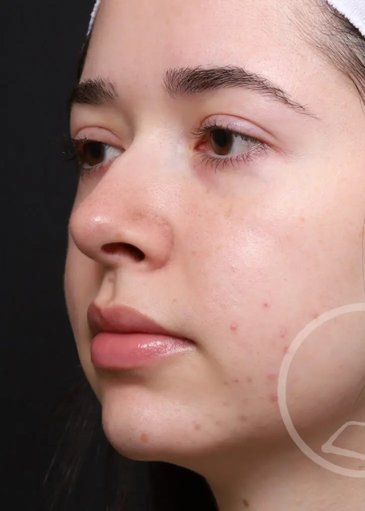 Plastic Surgery Before and After Pictures in Jacksonville, FL - Garcia Facial Plastic Surgery
