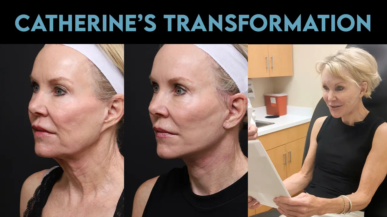 Catherine's Transformation