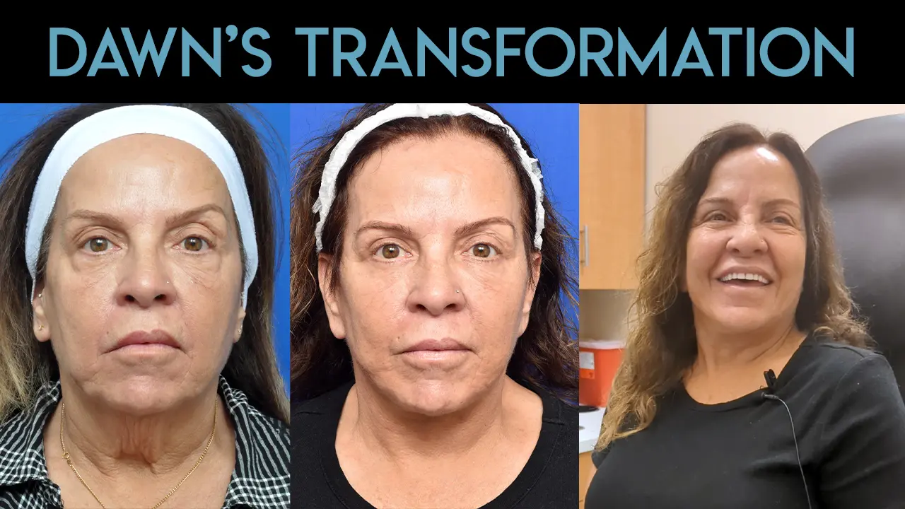 Dawn's Transformation
