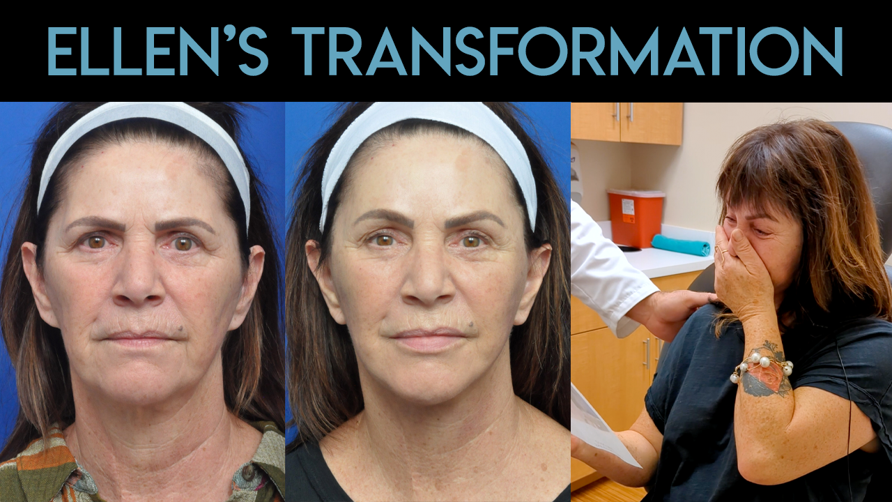 Ellen's Transformation