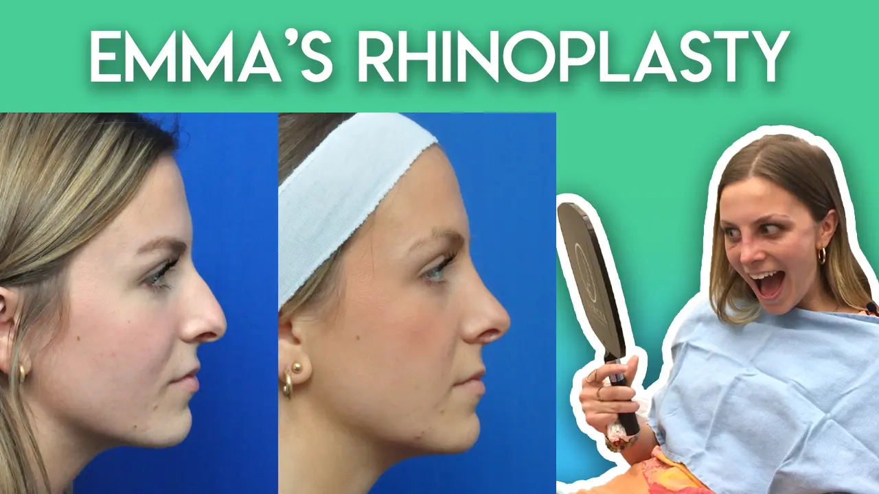 Emma's Rhinoplasty Journey
