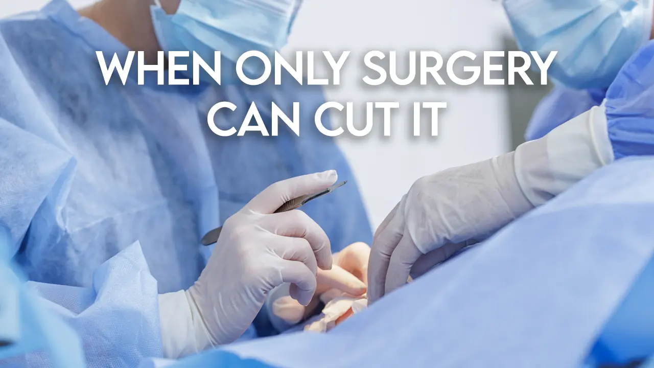 Only Surgery