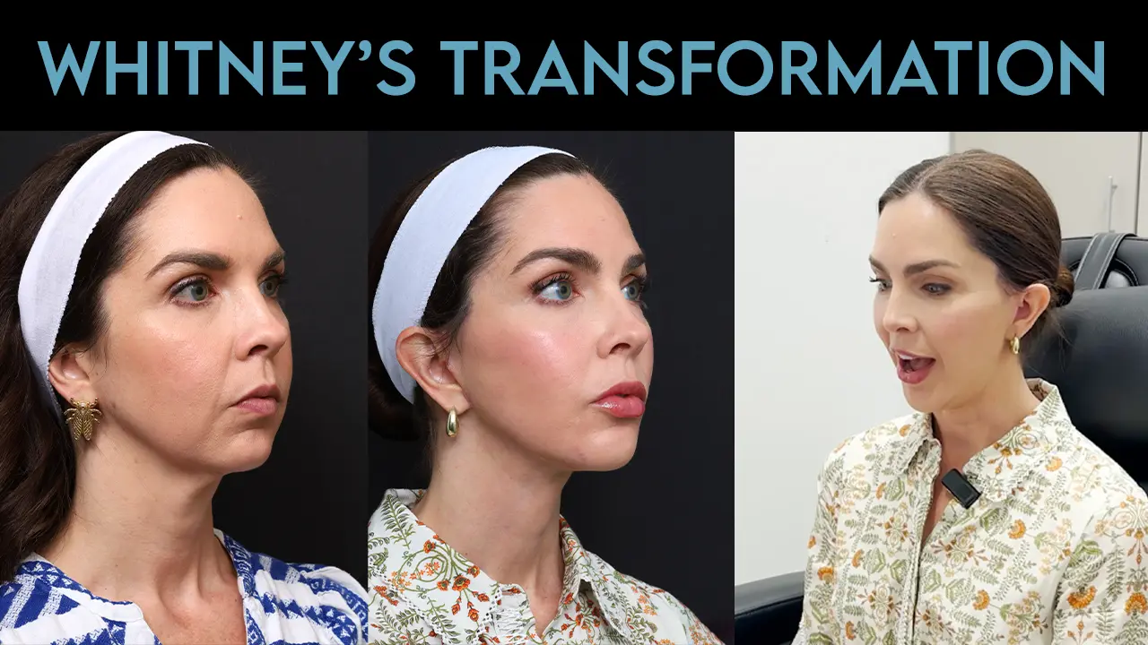 Whitney's Transformation