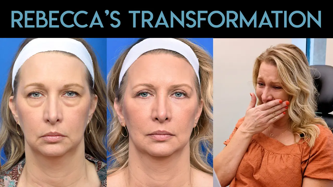 Rebecca's Transformation