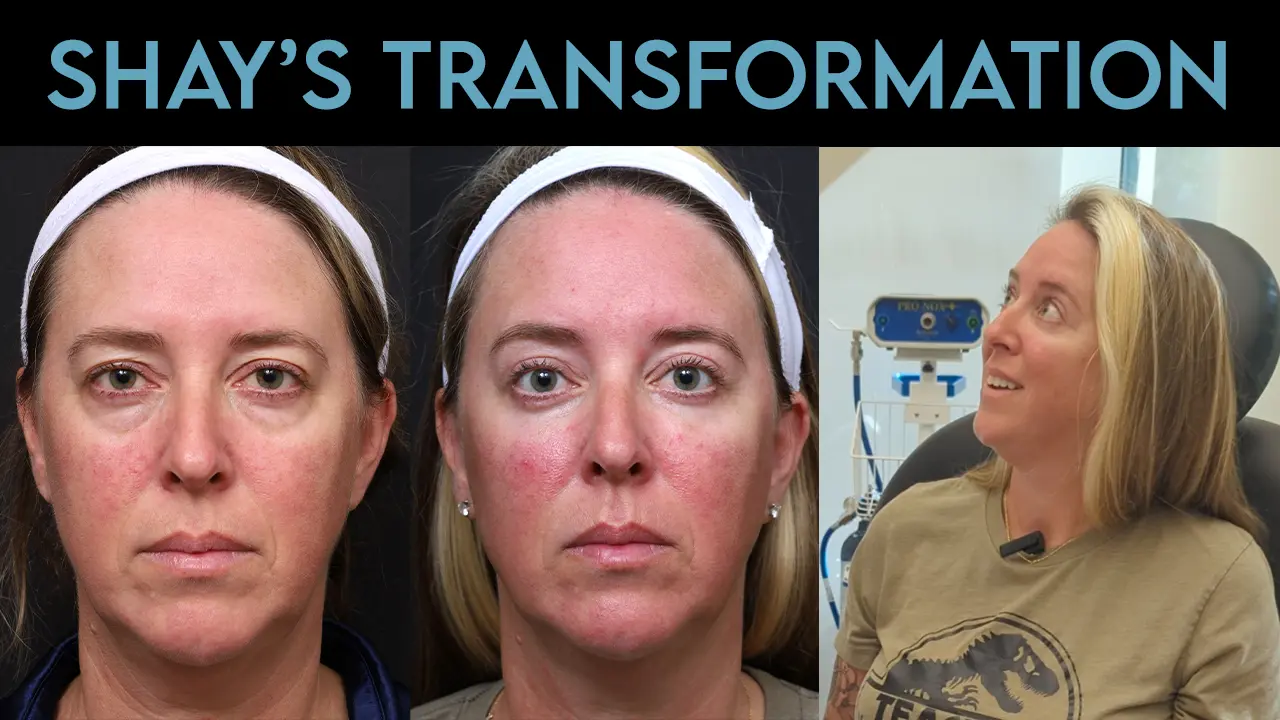 Shay's Transformation
