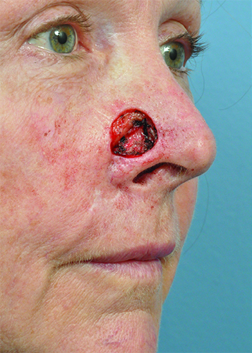 Facial Reconstruction Before and After Pictures Jacksonville, FL