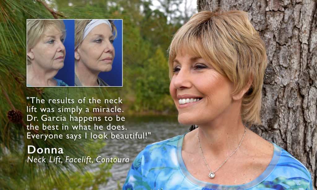 neck lift before and after pictures jacksonville ponte vedra beach