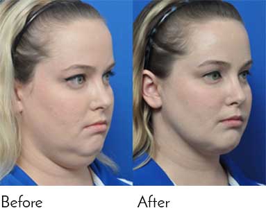 Testimonials - Garcia Facial Plastic Surgery