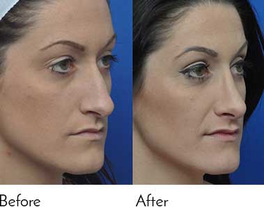 Testimonials - Garcia Facial Plastic Surgery