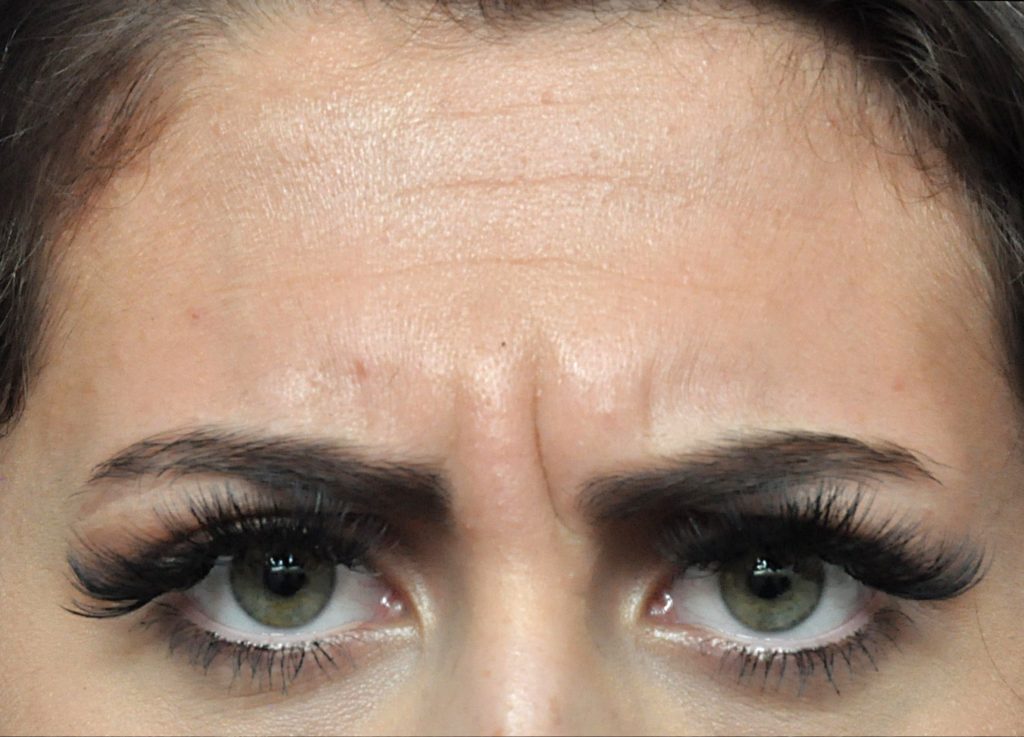 Plastic Surgery Before and After Pictures in Jacksonville, FL - Garcia Facial Plastic Surgery