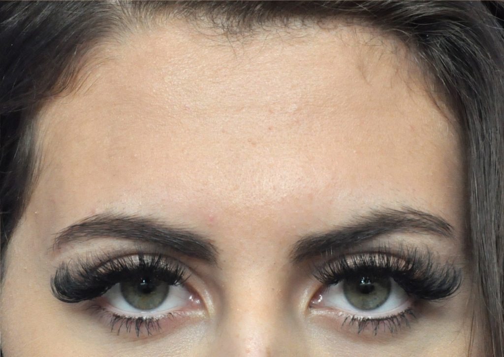 Plastic Surgery Before and After Pictures in Jacksonville, FL - Garcia Facial Plastic Surgery
