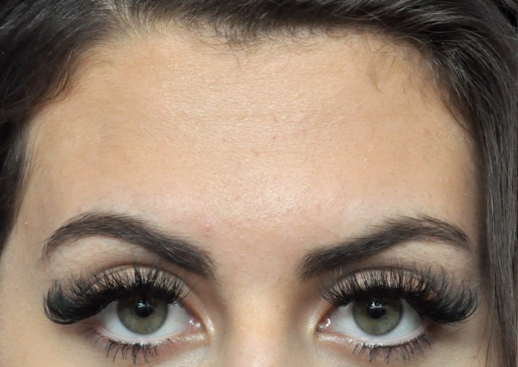Plastic Surgery Before and After Pictures in Jacksonville, FL - Garcia Facial Plastic Surgery