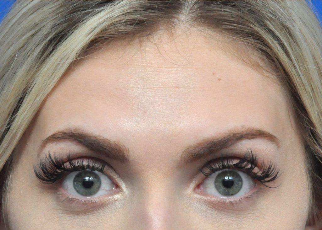 Plastic Surgery Before and After Pictures in Jacksonville, FL - Garcia Facial Plastic Surgery