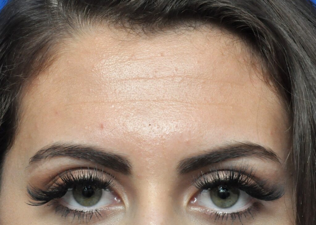 Plastic Surgery Before and After Pictures in Jacksonville, FL - Garcia Facial Plastic Surgery