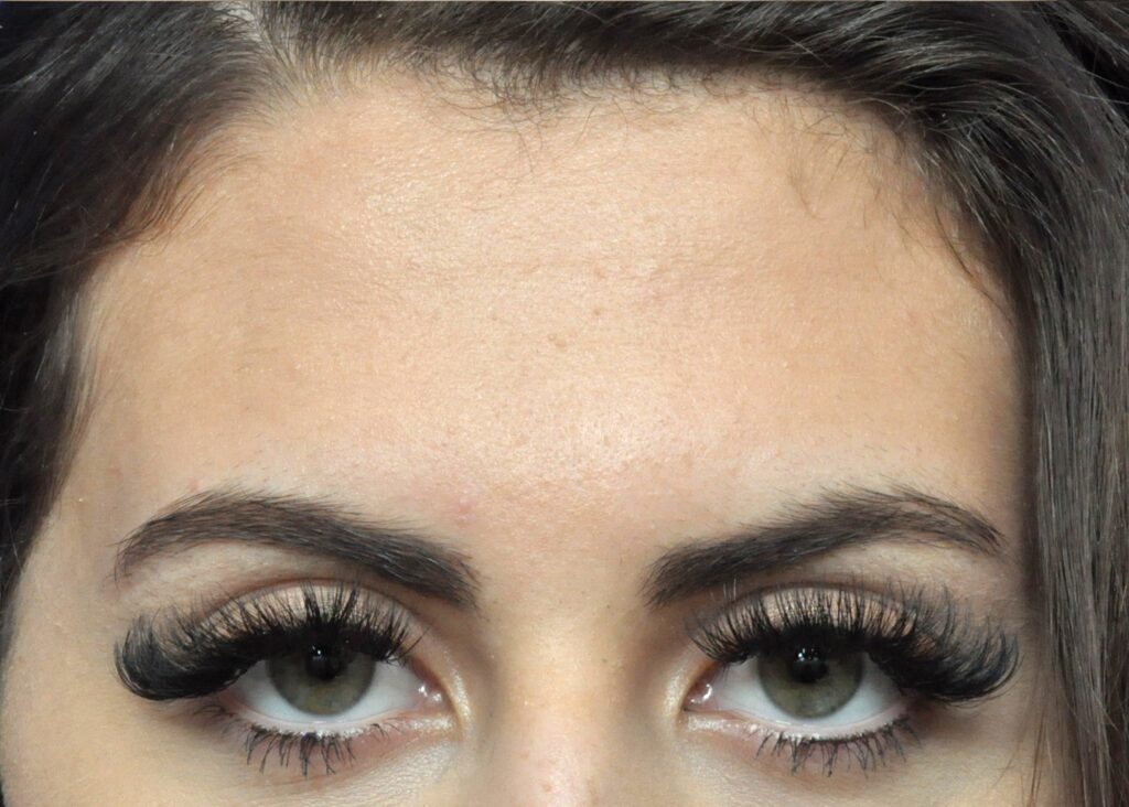 Plastic Surgery Before and After Pictures in Jacksonville, FL - Garcia Facial Plastic Surgery