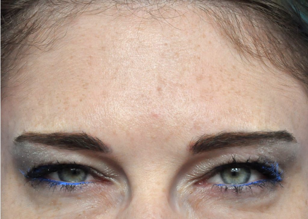 Plastic Surgery Before and After Pictures in Jacksonville, FL - Garcia Facial Plastic Surgery