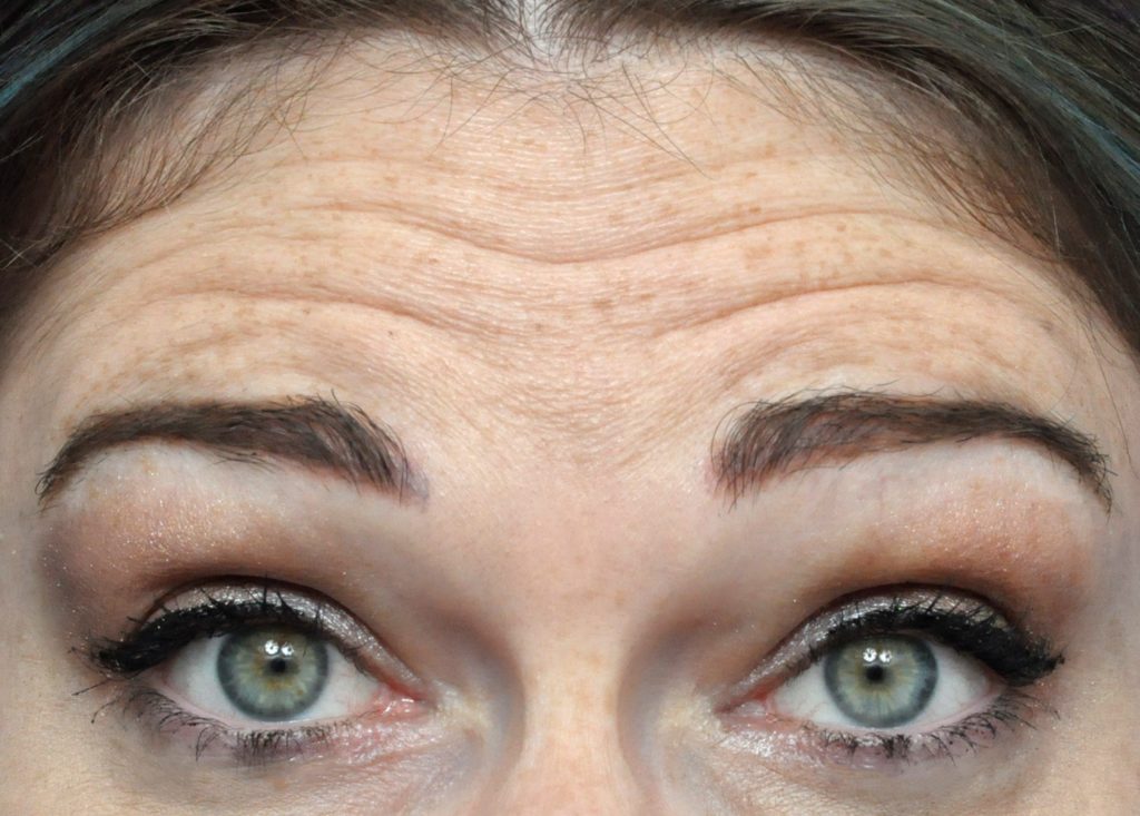 Plastic Surgery Before and After Pictures in Jacksonville, FL - Garcia Facial Plastic Surgery