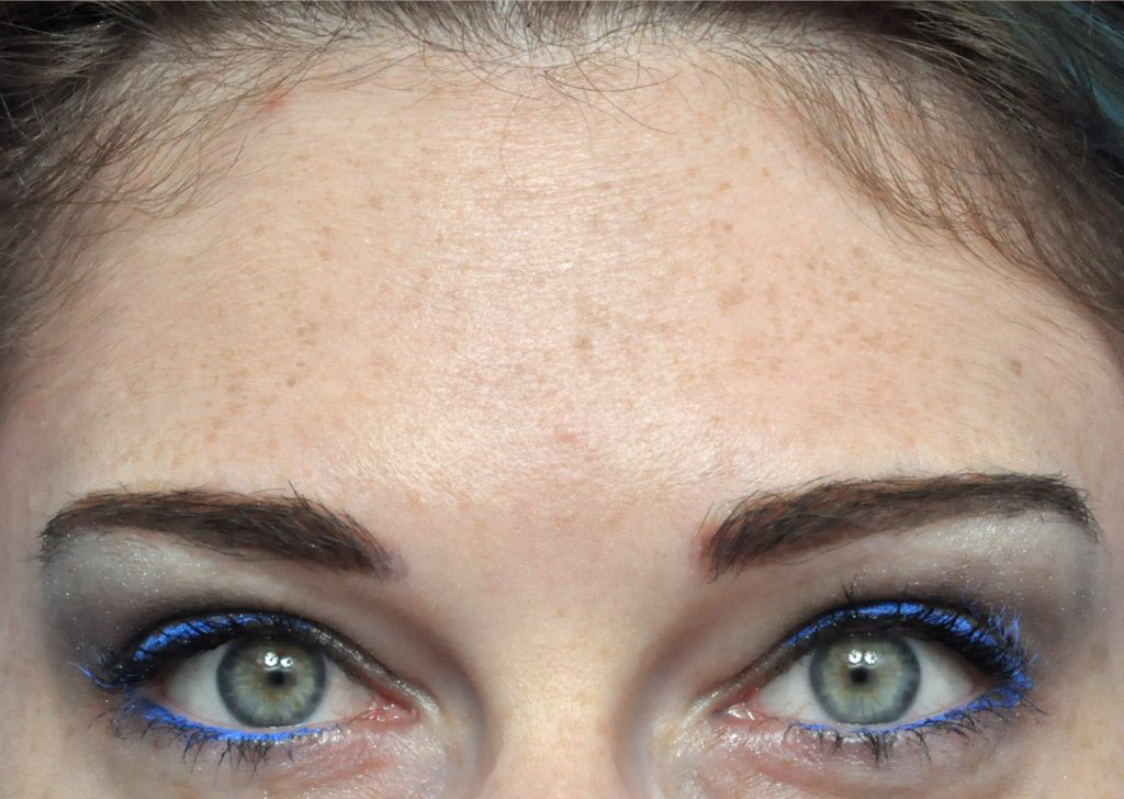 Plastic Surgery Before and After Pictures in Jacksonville, FL - Garcia Facial Plastic Surgery