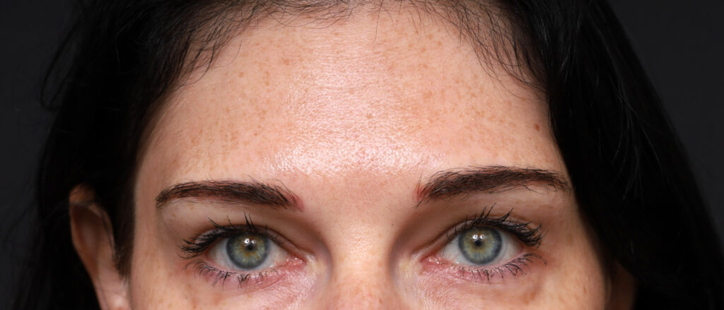 Plastic Surgery Before and After Pictures in Jacksonville, FL - Garcia Facial Plastic Surgery