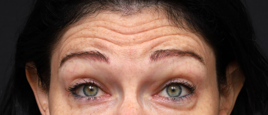 Plastic Surgery Before and After Pictures in Jacksonville, FL - Garcia Facial Plastic Surgery