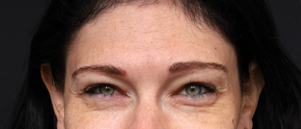Plastic Surgery Before and After Pictures in Jacksonville, FL - Garcia Facial Plastic Surgery