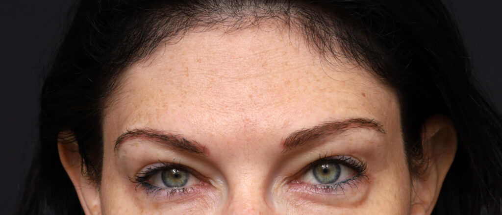 Plastic Surgery Before and After Pictures in Jacksonville, FL - Garcia Facial Plastic Surgery