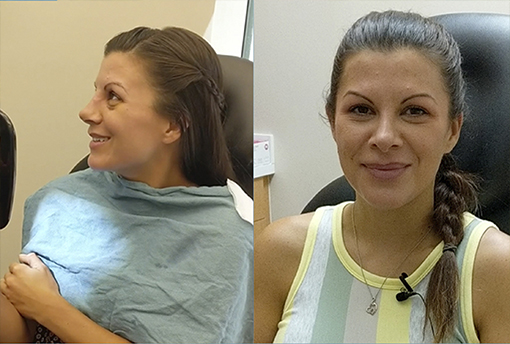 Testimonials - Garcia Facial Plastic Surgery