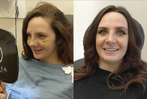 Testimonials - Garcia Facial Plastic Surgery