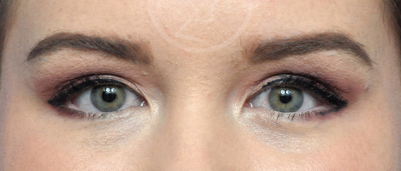 Blepharoplasty Before and After Pictures Jacksonville, FL