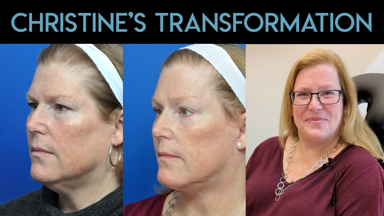 Christine's Transformation