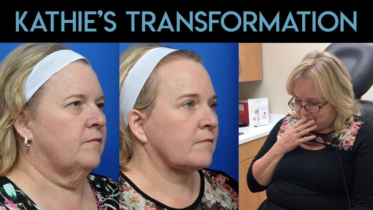Katie's Transformation Video