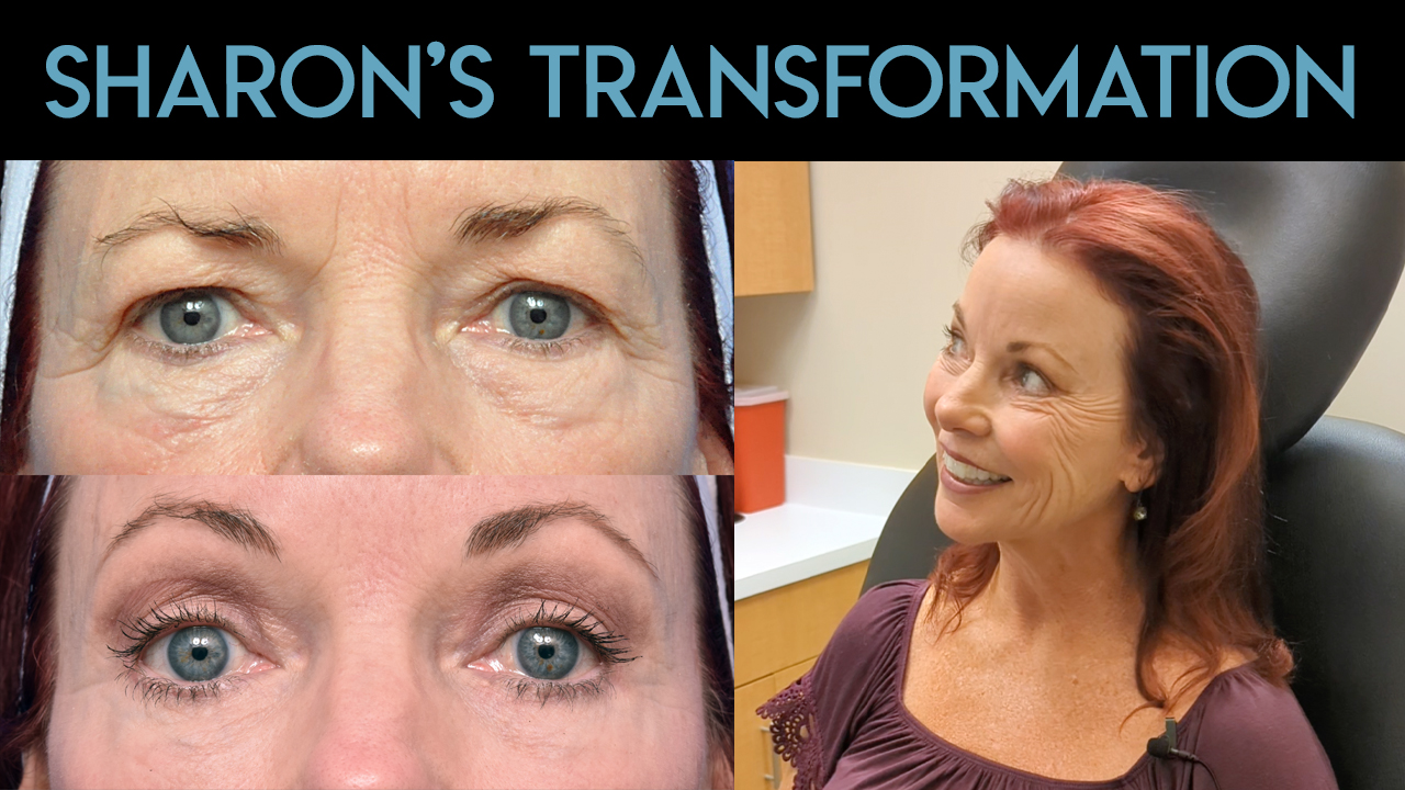 Sharon's Transformation Video
