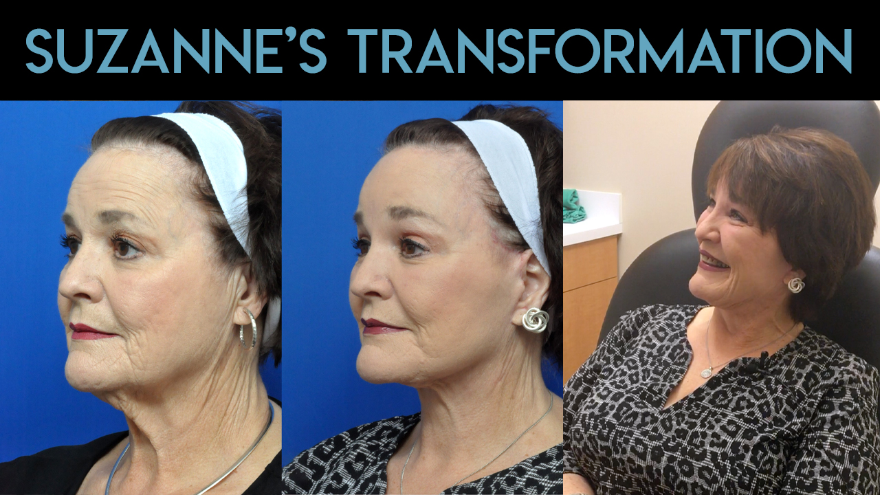 Suzanne's Transformation Video