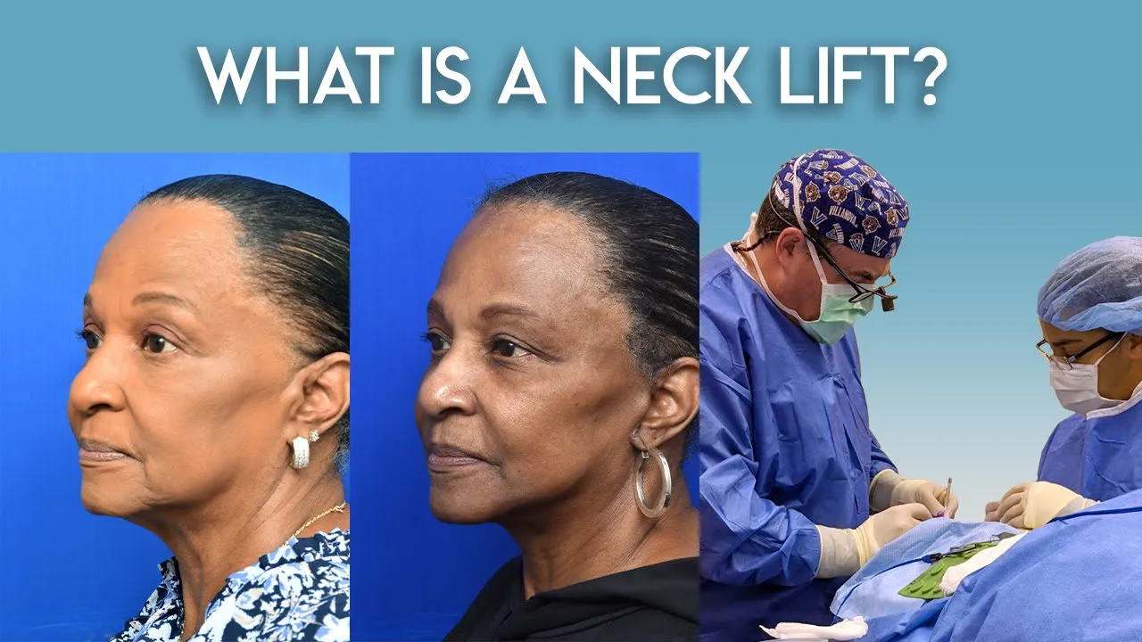 What is a Neck Lift?